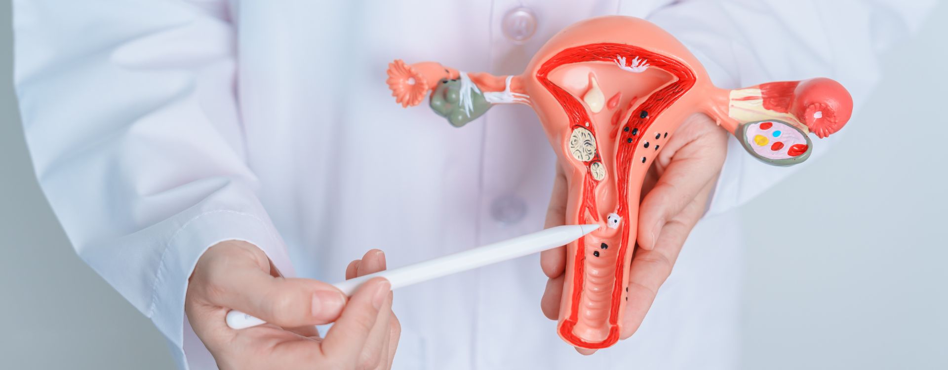 endometriosis