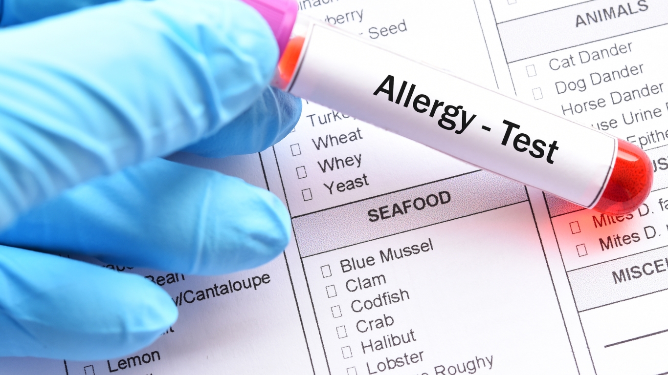 allergy test